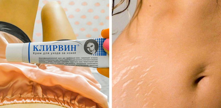 10+ средств из аптеки, которые работают не хуже дорогой косметики, а стоят копейки