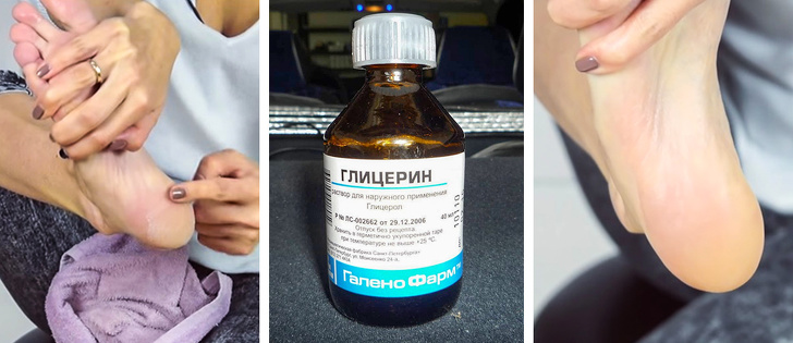 10+ средств из аптеки, которые работают не хуже дорогой косметики, а стоят копейки