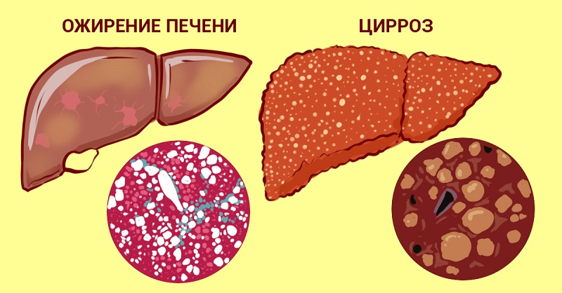 Эта хитрость защищает печень от разрушения! Нужно пить… Чтобы шлаки и токсины вышли.