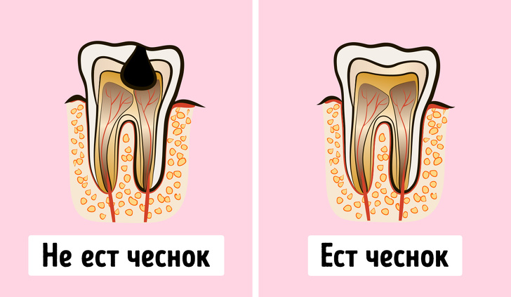 Что будет, если есть чеснок каждый день