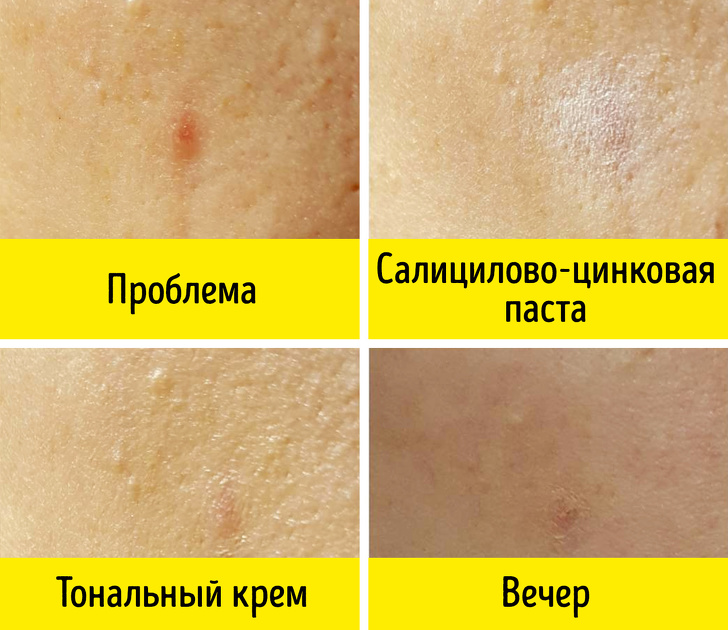 11 бюджетных средств из аптеки, которые работают не хуже дорогой косметики