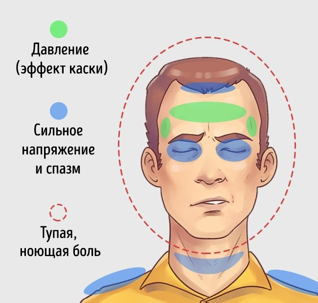 5 типов головной боли и способы быстро от них избавиться