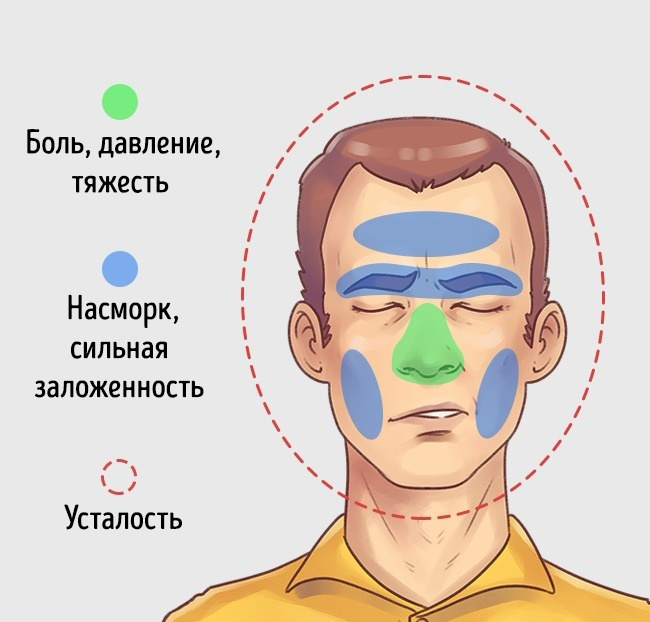 5 типов головной боли и способы быстро от них избавиться