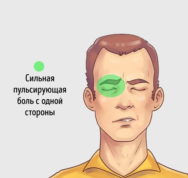 5 типов головной боли и способы быстро от них избавиться