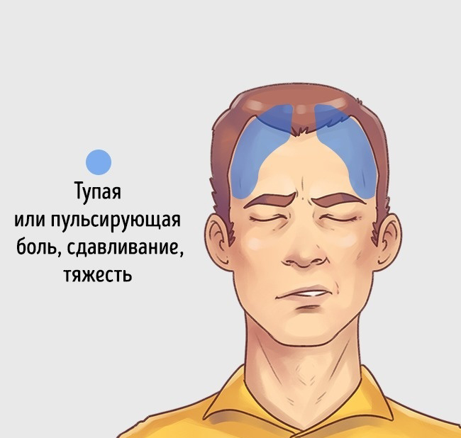 5 типов головной боли и способы быстро от них избавиться