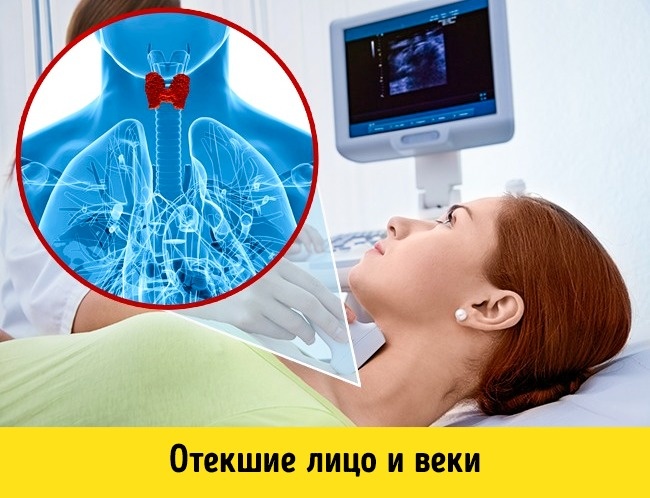 7 медицинских причин постоянной усталости