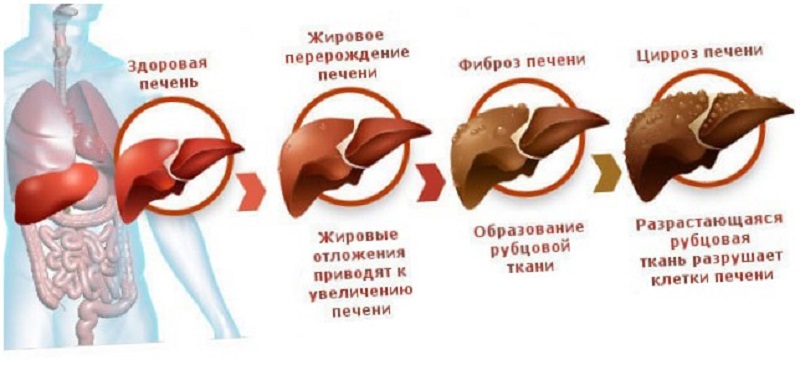 Чистим печень, худеем, обновляем клетки организма! 72 часа и пару чашечек…