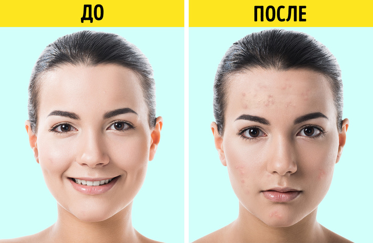 7 косметических продуктов, которые попали в черный список дерматологов