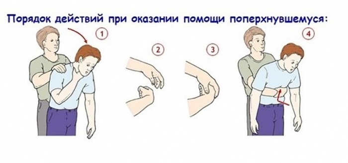 Что делать, если подавился, а рядом никого? Спасаться самому!