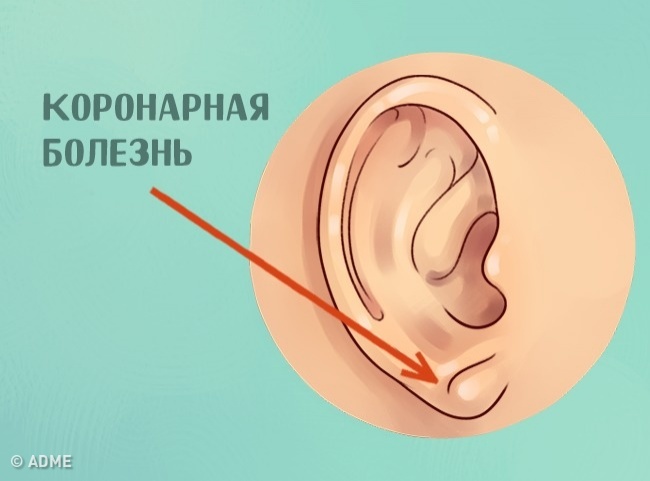 Узнайте, что ваши уши говорят о вас
