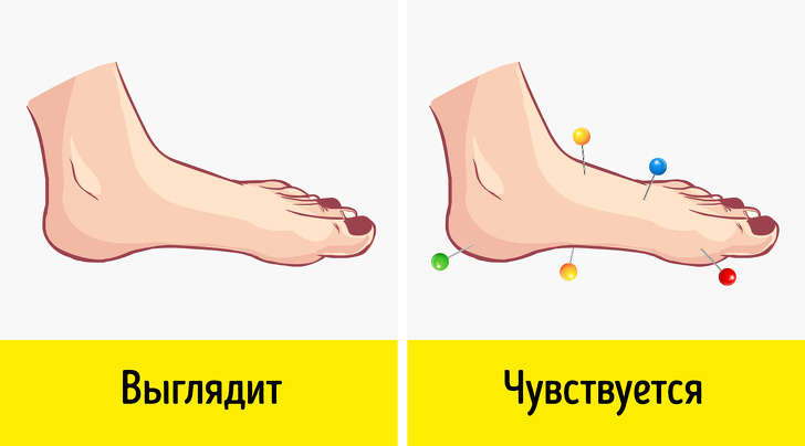 7 неочевидных симптомов, говорящих о том, что у вас нарушено кровообращение