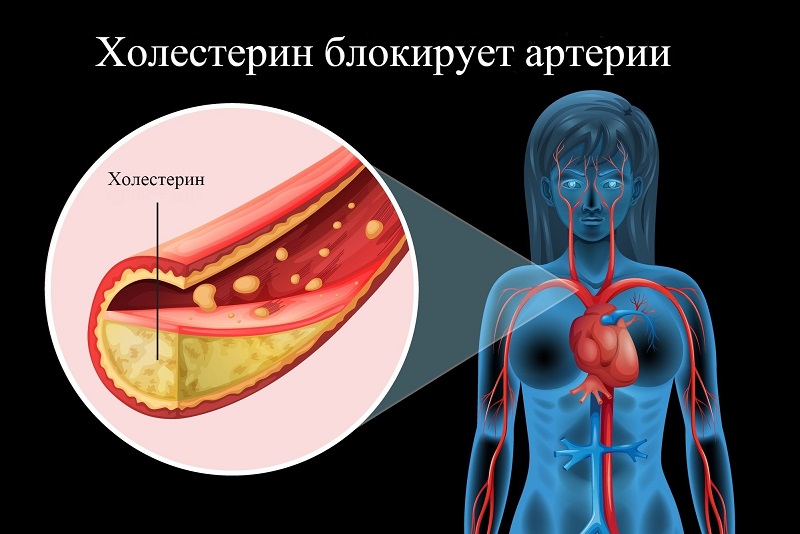 Держи сосуды в чистоте и тонусе: 5 золотых рецептов от травника. Приводим холестерин в норму и укрепляем сосуды без лекарств.
