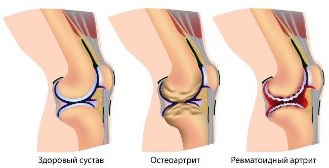 Тест на определение вашего биологического возраста