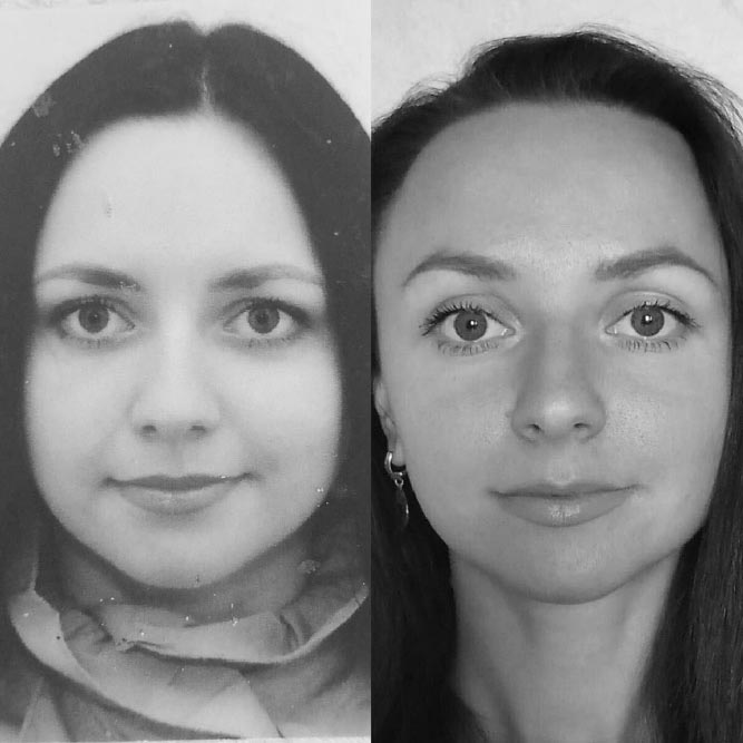 Отекает лицо по утрам? Лимфодренажная гимнастика для тела Отекает лицо по утрам? Лимфодренажная гимнастика для тела